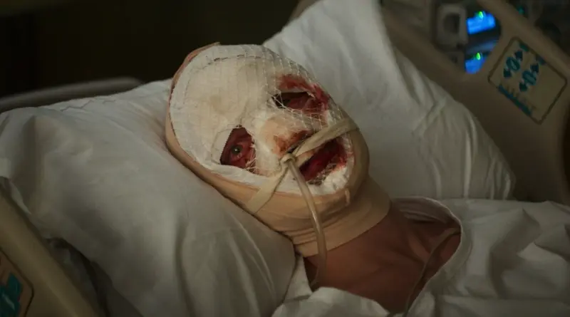 Personaje con el rostro vendado y ensangrentado en una cama de hospital de la película Clayface.